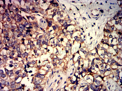 Валидация AntibodySystem RHN97801