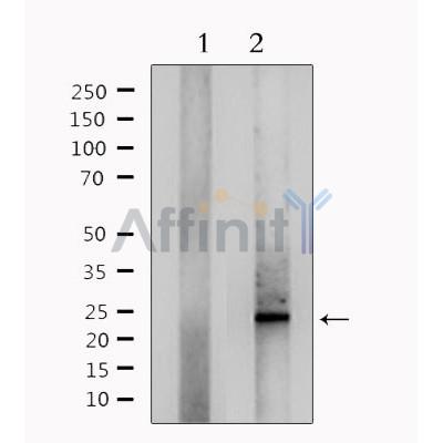 Валидация Affinity DF8377 - 20248