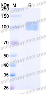 EHG76501, SDS-PAGE