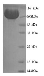 SDS-PAGE