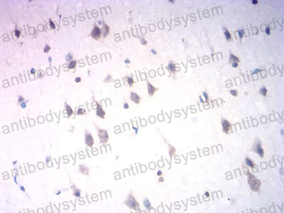 Валидация AntibodySystem RHG58701 (3021)