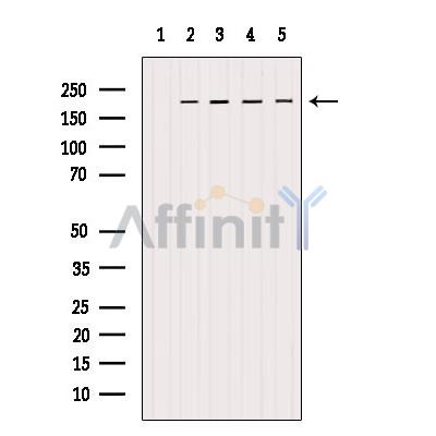 Валидация Affinity AF6069 - 3272