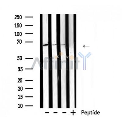 Валидация Affinity DF6172 - 17417