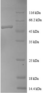 SDS-PAGE
