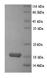 SDS-PAGE