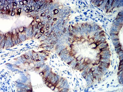 Валидация AntibodySystem RHB83302