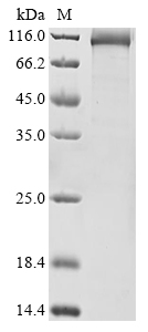 SDS-PAGE