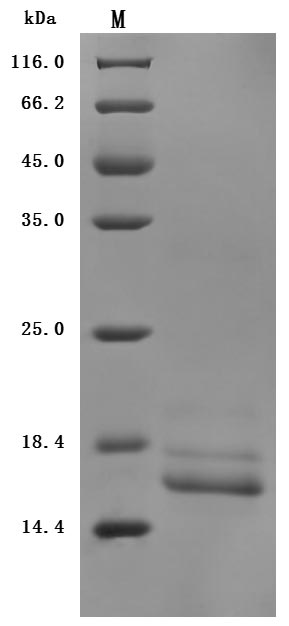 SDS-PAGE
