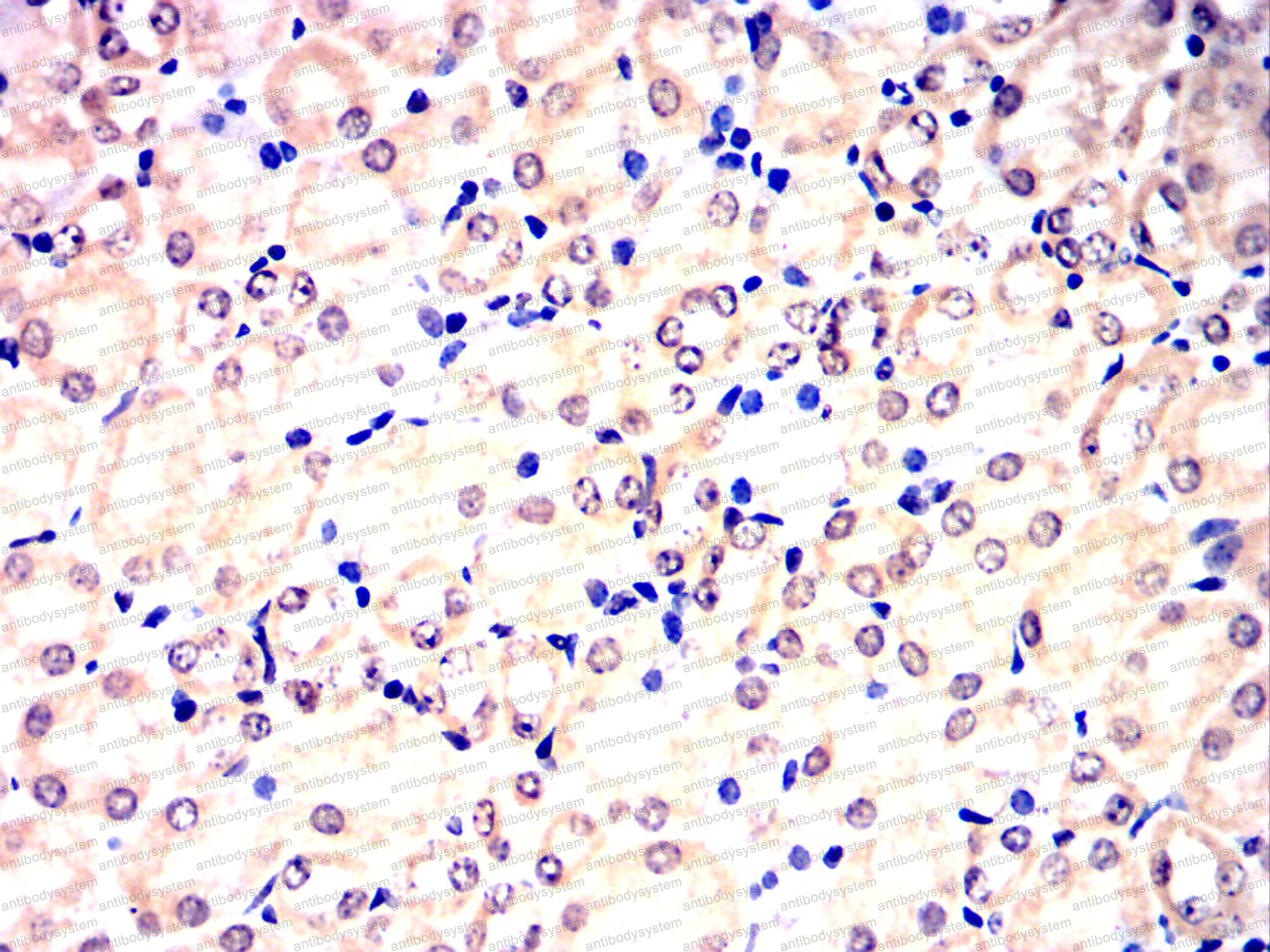 Валидация AntibodySystem RHE78702 (2324)