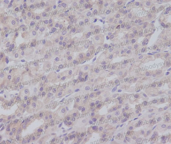 Валидация AntibodySystem RHN62002