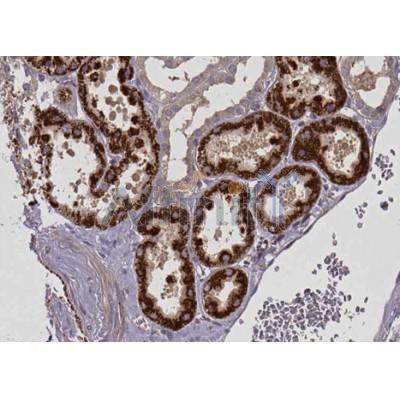 Валидация Affinity DF12004 - 6001