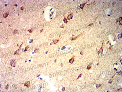 Валидация AntibodySystem RHJ71903