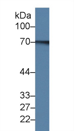 14357