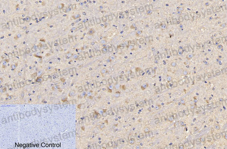 Валидация AntibodySystem RHB95907 (486)