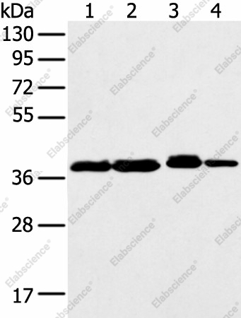 Вестерн-блоттинг, DCX, клетки 293T, K562, Jurkat