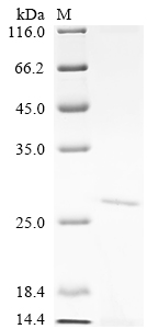 SDS-PAGE