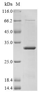 SDS-PAGE