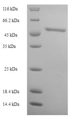 SDS-PAGE