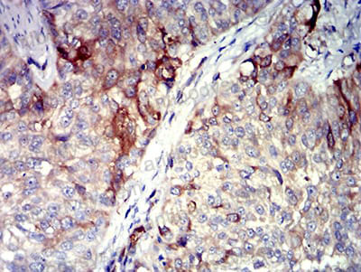 Валидация AntibodySystem RHA30302