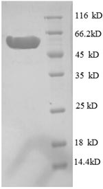 SDS-PAGE