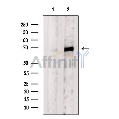 Валидация Affinity DF6419 - 17787