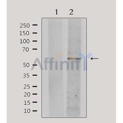 Валидация Affinity DF4722 - 16418