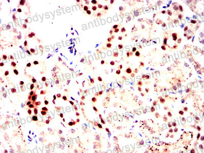 Валидация AntibodySystem RHE73902