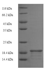 SDS-PAGE