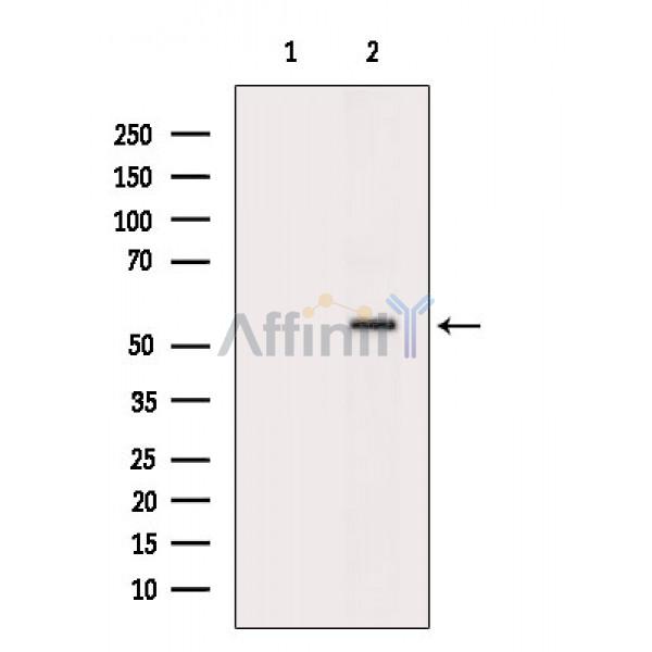 Валидация Affinity DF3300 - 14167