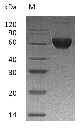 SDS-PAGE