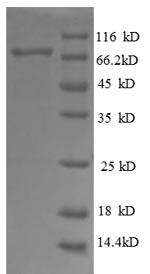 SDS-PAGE