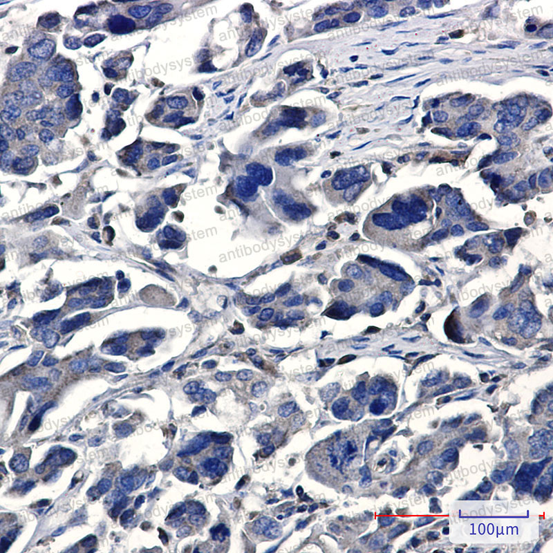 Валидация AntibodySystem RHG59601