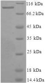 SDS-PAGE