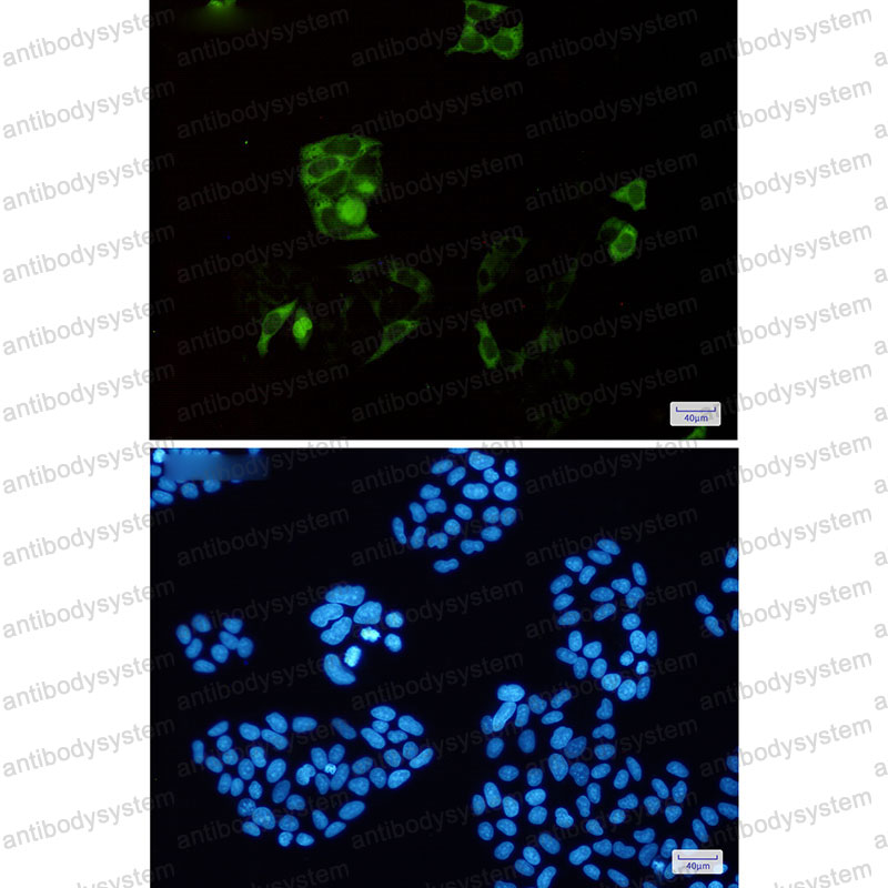 Валидация IF - AntibodySystem RHD05701