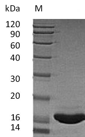 SDS-PAGE
