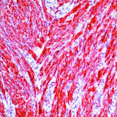 Валидация AssayVector ARM1126(354)