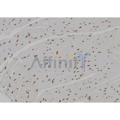 Валидация Affinity DF6665 - 18150