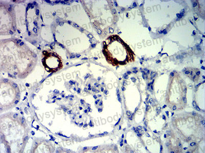 Валидация AntibodySystem RHF87803