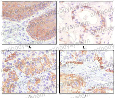 Валидация AntibodySystem RHC99502 (1250)