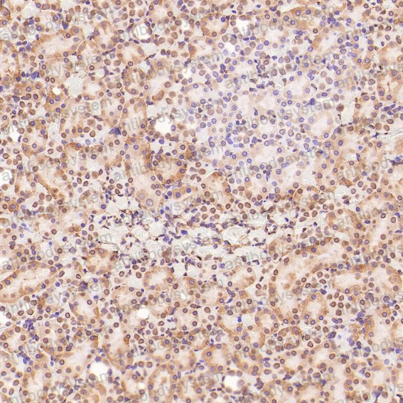 Валидация AntibodySystem RHC40302 (1005)