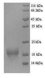 SDS-PAGE