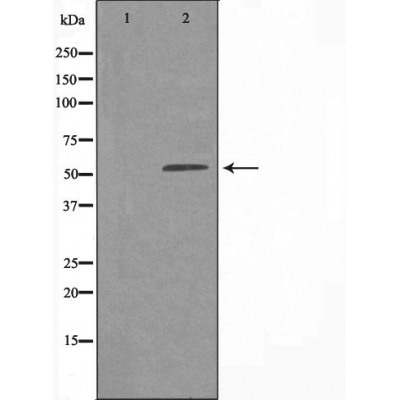 Валидация Affinity DF4577 - 16178