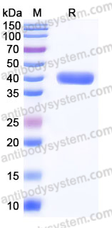 YHK28102, SDS-PAGE