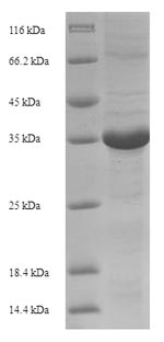 SDS-PAGE