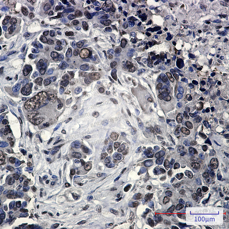 Валидация AntibodySystem RHJ37103