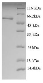 SDS-PAGE