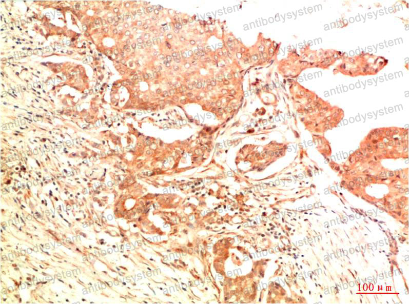 Валидация AntibodySystem RHC10009 (619)