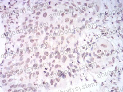 Валидация AntibodySystem RHD70003