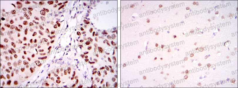 Валидация AntibodySystem RHB22004