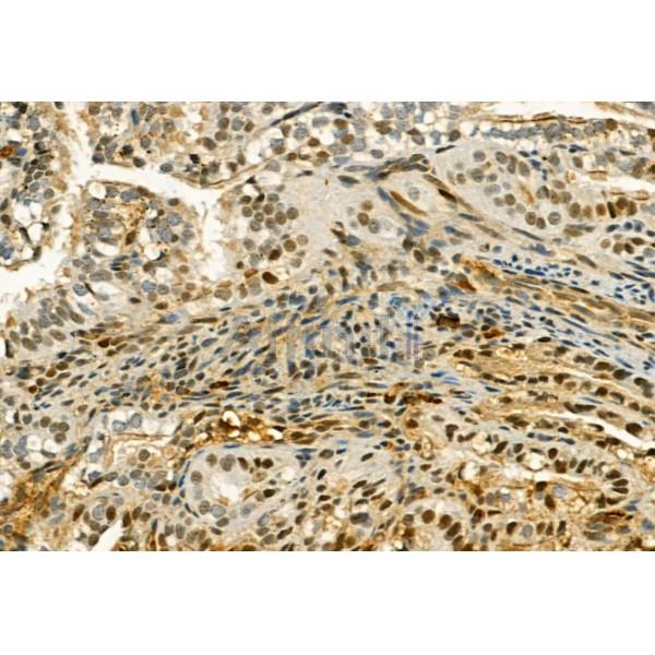 Валидация Affinity AF6090 - 3298